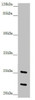 Western blot<br />
 All lanes: REEP1 antibody at 7.6 µg/ml + Mouse gonadal tissue<br />
 Secondary<br />
 Goat polyclonal to rabbit IgG at 1/10000 dilution<br />
 Predicted band size: 23, 19, 17 kDa<br />
 Observed band size: 23, 26 kDa<br />