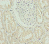 Immunohistochemistry of paraffin-embedded human kidney tissue using CSB-PA747413ESR2HU at dilution of 1:100