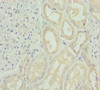 Immunohistochemistry of paraffin-embedded human kidney tissue using CSB-PA021874ESR1HU at dilution of 1:100