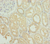 Immunohistochemistry of paraffin-embedded human kidney tissue using CSB-PA021874ESR2HU at dilution of 1:100