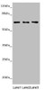 Western blot<br />
 All lanes: STXBP2 antibody at 4.1µg/ml<br />
 Lane 1: Mouse gonadal tissue<br />
 Lane 2: Jurkat whole cell lysate<br />
 Lane 3: A549 whole cell lysate<br />
 Secondary<br />
 Goat polyclonal to rabbit IgG at 1/10000 dilution<br />
 Predicted band size: 67, 68 kDa<br />
 Observed band size: 67 kDa<br />