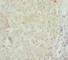 Immunohistochemistry of paraffin-embedded human liver tissue using CSB-PA618999ESR2HU at dilution of 1:100