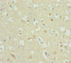 Immunohistochemistry of paraffin-embedded human brain tissue using CSB-PA878903DSR1HU at dilution of 1:100