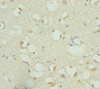 Immunohistochemistry of paraffin-embedded human brain tissue using CSB-PA878903DSR2HU at dilution of 1:100