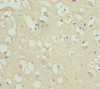 Immunohistochemistry of paraffin-embedded human brain tissue using CSB-PA892139ESR1HU at dilution of 1:100