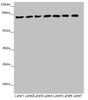 Western blot<br />
 All lanes: ACSL6 antibody at 4.64µg/ml<br />
 Lane 1: Mouse liver tissue<br />
 Lane 2: Mouse heart tissue<br />
 Lane 3: Mouse brain tissue<br />
 Lane 4: Mouse gonadal tissue<br />
 Lane 5: Jurkat whole cell lysate<br />
 Lane 6: Raji whole cell lysate<br />
 Lane 7: K562 whole cell lysate<br />
 Secondary<br />
 Goat polyclonal to rabbit IgG at 1/10000 dilution<br />
 Predicted band size: 78, 81, 75, 77, 80, 70 kDa<br />
 Observed band size: 78 kDa<br />