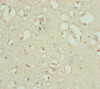 Immunohistochemistry of paraffin-embedded human brain tissue using CSB-PA892139ESR2HU at dilution of 1:100