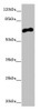 Western blot<br />
 All lanes: CACNB1 antibody at 6.68µg/ml + HepG2 whole cell lysate<br />
 Secondary<br />
 Goat polyclonal to rabbit IgG at 1/10000 dilution<br />
 Predicted band size: 66, 58, 54 kDa<br />
 Observed band size: 66 kDa<br />