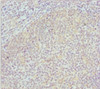 Immunohistochemistry of paraffin-embedded human tonsil tissue using CSB-PA881003ESR2HU at dilution of 1:100