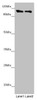 Western blot<br />
 All lanes: DDX11 antibody at 8.47µg/ml<br />
 Lane 1: Mouse gonadal tissue<br />
 Lane 2: K562 whole cell lysate<br />
 Secondary<br />
 Goat polyclonal to rabbit IgG at 1/10000 dilution<br />
 Predicted band size: 109, 102, 99, 97, 33 kDa<br />
 Observed band size: 109 kDa<br /> Western blot<br />
 All lanes: DDX11 antibody at 8.47µg/ml<br />
 Lane 1: Mouse gonadal tissue<br />
 Lane 2: K562 whole cell lysate<br />
 Secondary<br />
 Goat polyclonal to rabbit IgG at 1/10000 dilution<br />
 Predicted band size: 109, 102, 99, 97, 33 kDa<br />
 Observed band size: 109 kDa<br />