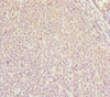 Immunohistochemistry of paraffin-embedded human tonsil tissue using CSB-PA853416ESR2HU at dilution of 1:100