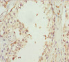 Immunohistochemistry of paraffin-embedded human testis tissue using CSB-PA708490ESR1HU at dilution of 1:100