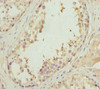 Immunohistochemistry of paraffin-embedded human testis tissue using CSB-PA708490ESR2HU at dilution of 1:100