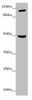 Western blot<br />
 All lanes: INPP4A antibody at 7.06 µg/ml + Mouse brain tissue<br />
 Secondary<br />
 Goat polyclonal to rabbit IgG at 1/10000 dilution<br />
 Predicted band size: 110, 106, 108 kDa<br />
 Observed band size: 110, 48 kDa<br />