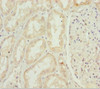 Immunohistochemistry of paraffin-embedded human kidney tissue using CSB-PA866277ESR2HU at dilution of 1:100