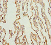 Immunohistochemistry of paraffin-embedded human lung tissue using CSB-PA859028ESR1HU at dilution of 1:100