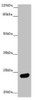 Western blot<br />
 All lanes: MRAS antibody at 2.61 µg/ml + Mouse brain tissue<br />
 Secondary<br />
 Goat polyclonal to rabbit IgG at 1/10000 dilution<br />
 Predicted band size: 24, 16 kDa<br />
 Observed band size: 24 kDa<br />