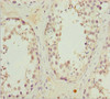 Immunohistochemistry of paraffin-embedded human testis tissue using CSB-PA014781ESR2HU at dilution of 1:100