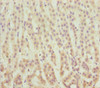 Immunohistochemistry of paraffin-embedded human adrenal gland tissue using CSB-PA810290DSR2HU at dilution of 1:100