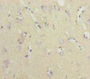 Immunohistochemistry of paraffin-embedded human brain tissue using CSB-PA016028ESR1HU at dilution of 1:100