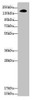 Western blot<br />
 All lanes: NUP155 antibody at 3.47µg/ml + Hela whole cell lysate<br />
 Secondary<br />
 Goat polyclonal to rabbit IgG at 1/10000 dilution<br />
 Predicted band size: 156, 150 kDa<br />
 Observed band size: 156 kDa<br />