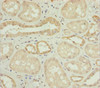 Immunohistochemistry of paraffin-embedded human kidney tissue using CSB-PA016237ESR1HU at dilution of 1:100