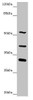 Western blot<br />
 All lanes: NYX antibody at 4.91 µg/ml<br />
  + Mouse liver tissue<br />
 Secondary<br />
 Goat polyclonal to rabbit IgG at 1/10000 dilution<br />
 Predicted band size: 52 kDa<br />
 Observed band size: 52, 32, 39 kDa<br />