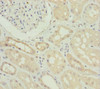 Immunohistochemistry of paraffin-embedded human kidney tissue using CSB-PA016237ESR2HU at dilution of 1:100