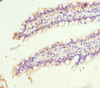 Immunohistochemistry of paraffin-embedded human small intestine tissue using CSB-PA836278ESR1HU at dilution of 1:100