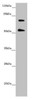 Western blot<br />
 All lanes: ABCB8 antibody at 2.02 µg/ml<br />
  + Mouse heart tissue<br />
 Secondary<br />
 Goat polyclonal to rabbit IgG at 1/10000 dilution<br />
 Predicted band size: 80, 79, 76, 69, 60 kDa<br />
 Observed band size: 80, 55 kDa<br />