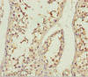 Immunohistochemistry of paraffin-embedded human testis tissue using CSB-PA868325ESR1HU at dilution of 1:100