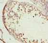 Immunohistochemistry of paraffin-embedded human testis tissue using CSB-PA868325ESR2HU at dilution of 1:100