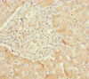 Immunohistochemistry of paraffin-embedded human liver tissue using CSB-PA892487ESR2HU at dilution of 1:100