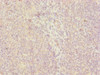 Immunohistochemistry of paraffin-embedded human tonsil tissue using CSB-PA818266ESR2HU at dilution of 1:100