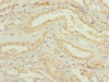 Immunohistochemistry of paraffin-embedded human kidney tissue using CSB-PA896730ESR1HU at dilution of 1:100