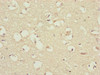 Immunohistochemistry of paraffin-embedded human brain tissue using CSB-PA896730ESR1HU at dilution of 1:100