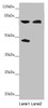 Western blot<br />
 All lanes: CEP83 antibody at 2.27 µg/ml<br />
 Lane 1: Mouse liver tissue<br />
 Lane 2: COLO205 whole cell lysate<br />
 Secondary<br />
 Goat polyclonal to rabbit IgG at 1/10000 dilution<br />
 Predicted band size: 83, 68 kDa<br />
 Observed band size: 83, 45 kDa<br />