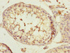 Immunohistochemistry of paraffin-embedded human testis tissue using CSB-PA854012ESR1HU at dilution of 1:100