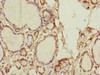 Immunohistochemistry of paraffin-embedded human thyroid tissue using CSB-PA854012ESR1HU at dilution of 1:100