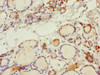 Immunohistochemistry of paraffin-embedded human thyroid tissue using CSB-PA854012ESR2HU at dilution of 1:100
