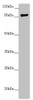 Western blot<br />
 All lanes: CCHCR1 antibody at 2.67 µg/ml + 293T whole cell lysate<br />
 Secondary<br />
 Goat polyclonal to rabbit IgG at 1/10000 dilution<br />
 Predicted band size: 89, 100, 96 kDa<br />
 Observed band size: 89 kDa<br />