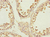 Immunohistochemistry of paraffin-embedded human testis tissue using CSB-PA004769ESR1HU at dilution of 1:100