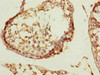 Immunohistochemistry of paraffin-embedded human testis tissue using CSB-PA004769ESR2HU at dilution of 1:100