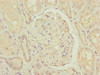 Immunohistochemistry of paraffin-embedded human kidney tissue using CSB-PA004769ESR2HU at dilution of 1:100