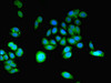 Immunofluorescent analysis of HepG2 cells using CSB-PA004769ESR2HU at dilution of 1:100 and Alexa Fluor 488-congugated AffiniPure Goat Anti-Rabbit IgG (H+L)