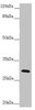 Western blot<br />
 All lanes: CENPH antibody at 1.61 µg/ml + Mouse lung tissue<br />
 Secondary<br />
 Goat polyclonal to rabbit IgG at 1/10000 dilution<br />
 Predicted band size: 28 kDa<br />
 Observed band size: 28 kDa<br />