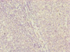 Immunohistochemistry of paraffin-embedded human tonsil tissue using CSB-PA005211ESR2HU at dilution of 1:100