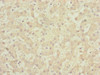 Immunohistochemistry of paraffin-embedded human liver tissue using CSB-PA005214ESR1HU at dilution of 1:100