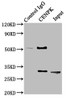 Immunoprecipitating CENPK in Hela whole cell lysate<br />
 Lane 1: Rabbit control IgG instead of CSB-PA005214ESR1HU in Hela whole cell lysate.
 For western blotting, a HRP-conjugated Protein G antibody was used as the secondary antibody (1/2000) <br />
 Lane 2: CSB-PA005214ESR1HU (8µg) + Hela whole cell lysate (500µg) <br />
 Lane 3: Hela whole cell lysate (10µg) <br />