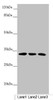 Western blot<br />
 All lanes: CENPK antibody at 4.17µg/ml<br />
 Lane 1: PC-3 whole cell lysate<br />
 Lane 2: 293T whole cell lysate<br />
 Lane 3: Hela whole cell lysate<br />
 Secondary<br />
 Goat polyclonal to rabbit IgG at 1/10000 dilution<br />
 Predicted band size: 32 kDa<br />
 Observed band size: 32 kDa<br />